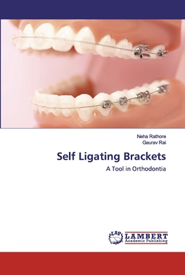 Self Ligating Brackets