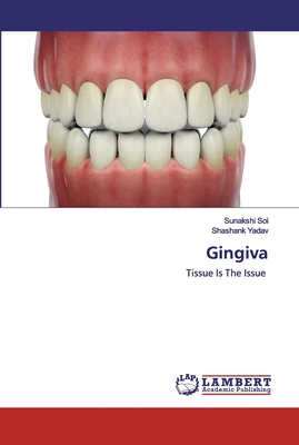 Gingiva