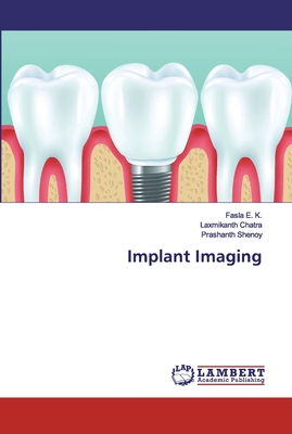 Implant Imaging