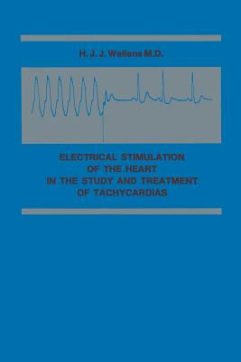 Electrical Stimulation of the Heart in the Study and Treatment of Tachycardias
