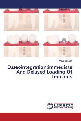 Osseointegration: Immediate and Delayed Loading of Implants