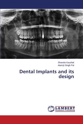 Dental Implants and Its Design