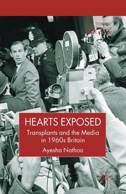 Hearts Exposed : Transplants and the Media in 1960s Britain