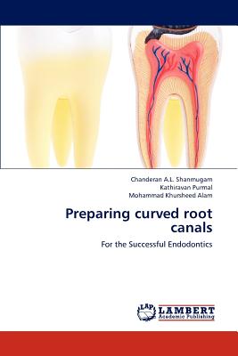 Preparing curved root canals