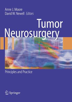 Tumor Neurosurgery : Principles and Practice