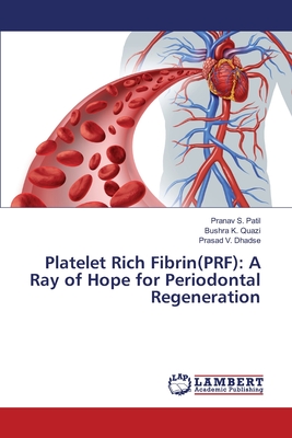 Platelet Rich Fibrin(PRF): A Ray of Hope for Periodontal Regeneration