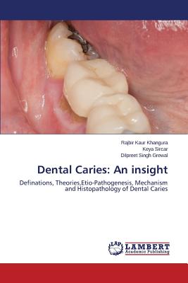 Dental Caries: An insight