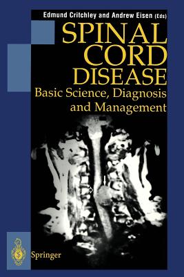 Spinal Cord Disease : Basic Science, Diagnosis and Management