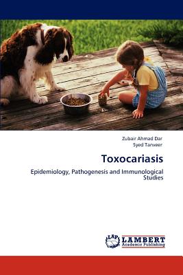 Toxocariasis