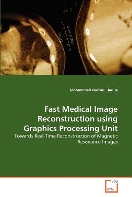 Fast Medical Image Reconstruction using Graphics Processing Unit