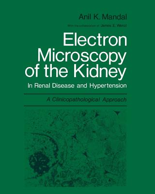 Electron Microscopy of the Kidney: In Renal Disease and Hypertension: A Clinicopathological Approach