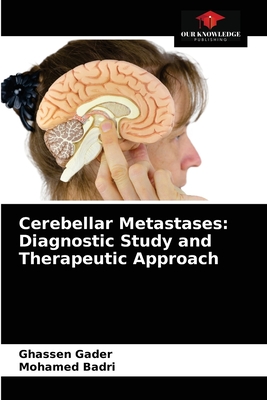 Cerebellar Metastases: Diagnostic Study and Therapeutic Approach