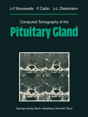 Computed Tomography of the Pituitary Gland: With a Chapter on Magnetic Resonance Imaging of the Sellar and Juxtasellar Region, by M. Mu Huo Teng and K