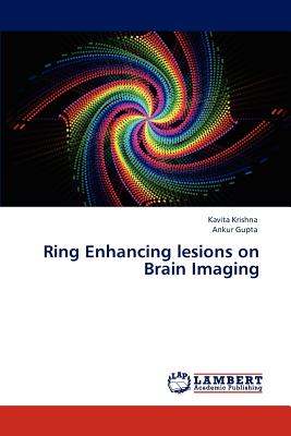 Ring Enhancing Lesions on Brain Imaging