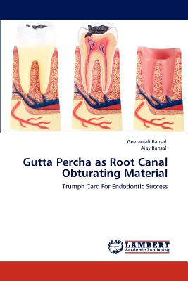 Gutta Percha as Root Canal Obturating Material