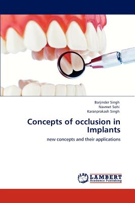 Concepts of occlusion in Implants