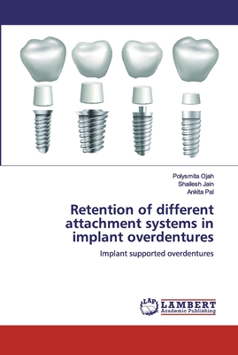 Retention of different attachment systems in implant overdentures