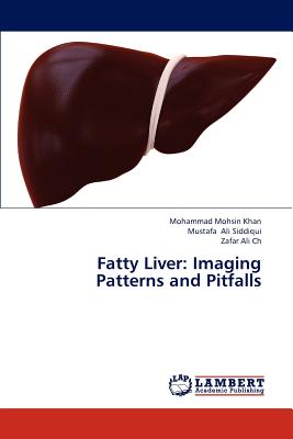 Fatty Liver: Imaging Patterns and Pitfalls