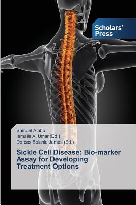 Sickle Cell Disease: Bio-marker Assay for Developing Treatment Options