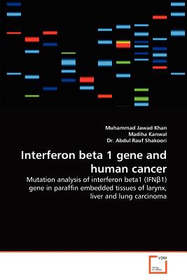 Interferon beta 1 gene and human cancer