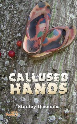 Callused Hands