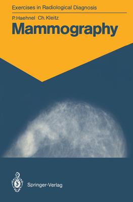 Nwf.com: Mammography: كتب