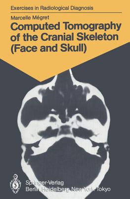 Computed Tomography of the Cranial Skeleton (Face and Skull)