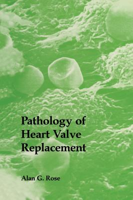 غلاف كتاب Pathology of Heart Valve Replacement