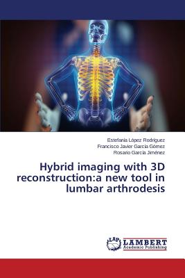 Hybrid imaging with 3D reconstruction:a new tool in lumbar arthrodesis