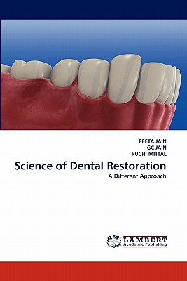 Science of Dental Restoration