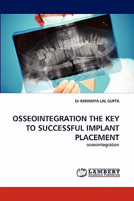 Osseointegration the Key to Successful Implant Placement