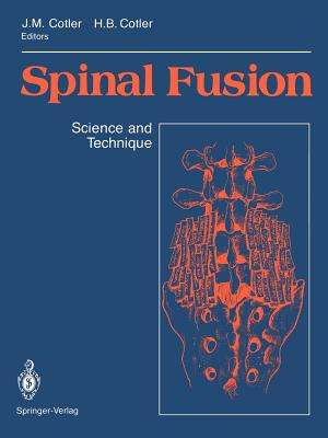 Spinal Fusion : Science and Technique