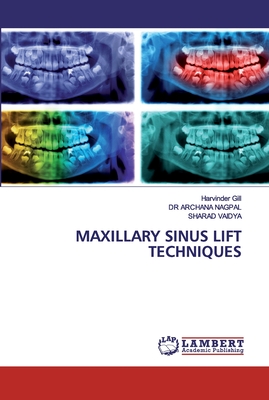 MAXILLARY SINUS LIFT TECHNIQUES