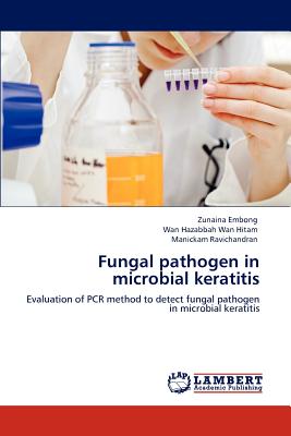 Fungal Pathogen in Microbial Keratitis