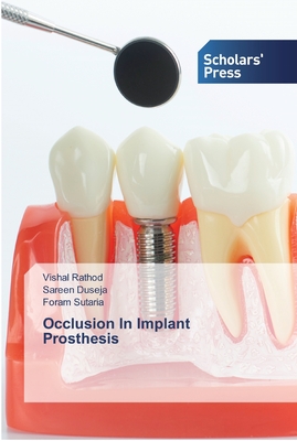 Occlusion In Implant Prosthesis