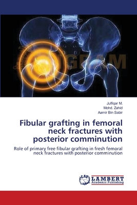 Fibular grafting in femoral neck fractures with posterior comminution