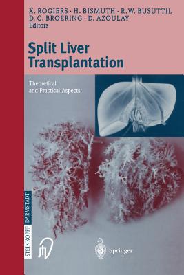 Split liver transplantation : Theoretical and practical aspects