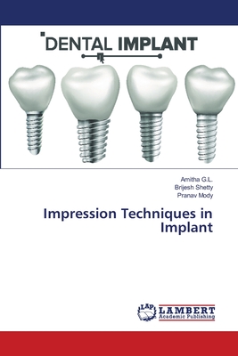 Impression Techniques in Implant