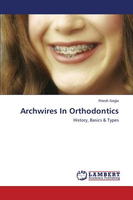 Archwires In Orthodontics