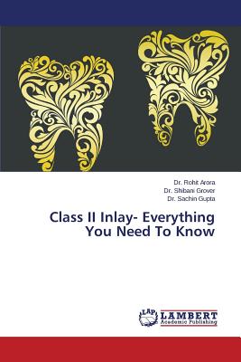 Class II Inlay- Everything You Need To Know