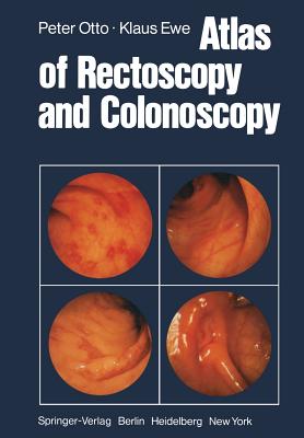 Atlas of Rectoscopy and Coloscopy