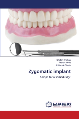 Zygomatic implant