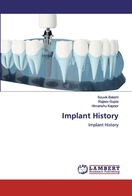 Implant History