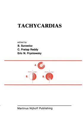 غلاف كتاب Tachycardias