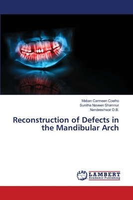 Reconstruction of Defects in the Mandibular Arch