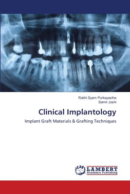 Clinical Implantology